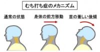 「車の衝突安全技術とは？ シートベルト・エアバッグ・衝撃吸収ボディなどを解説【自動車用語辞典】」の12枚目の画像ギャラリーへのリンク